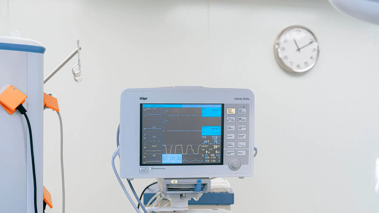 A wall-mounted monitor displaying vital signs for multiple patient beds